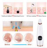 Pore Vacuum Pro